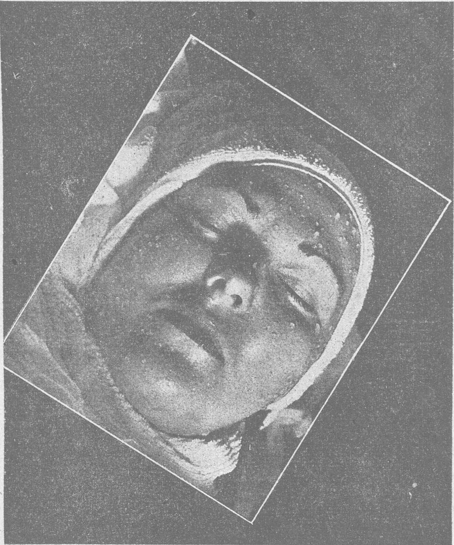 صورة امرأة أثناء علاج تجميلي للوجه
