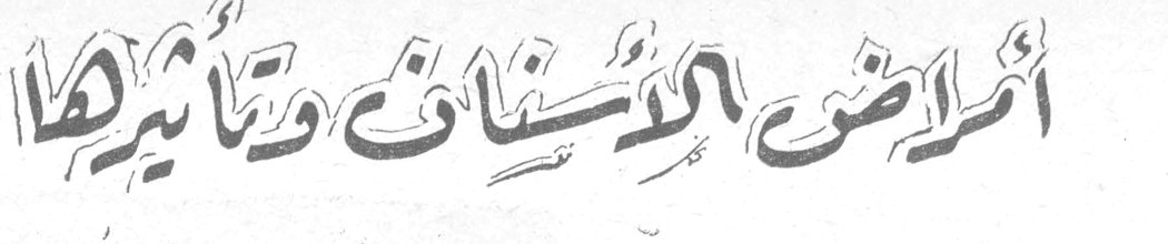أمراض الأسنان وتأثيرها