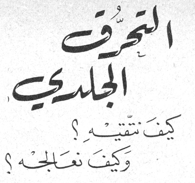 التحرق الجلدي - كيف نتقيه؟ وكيف نعالجه؟