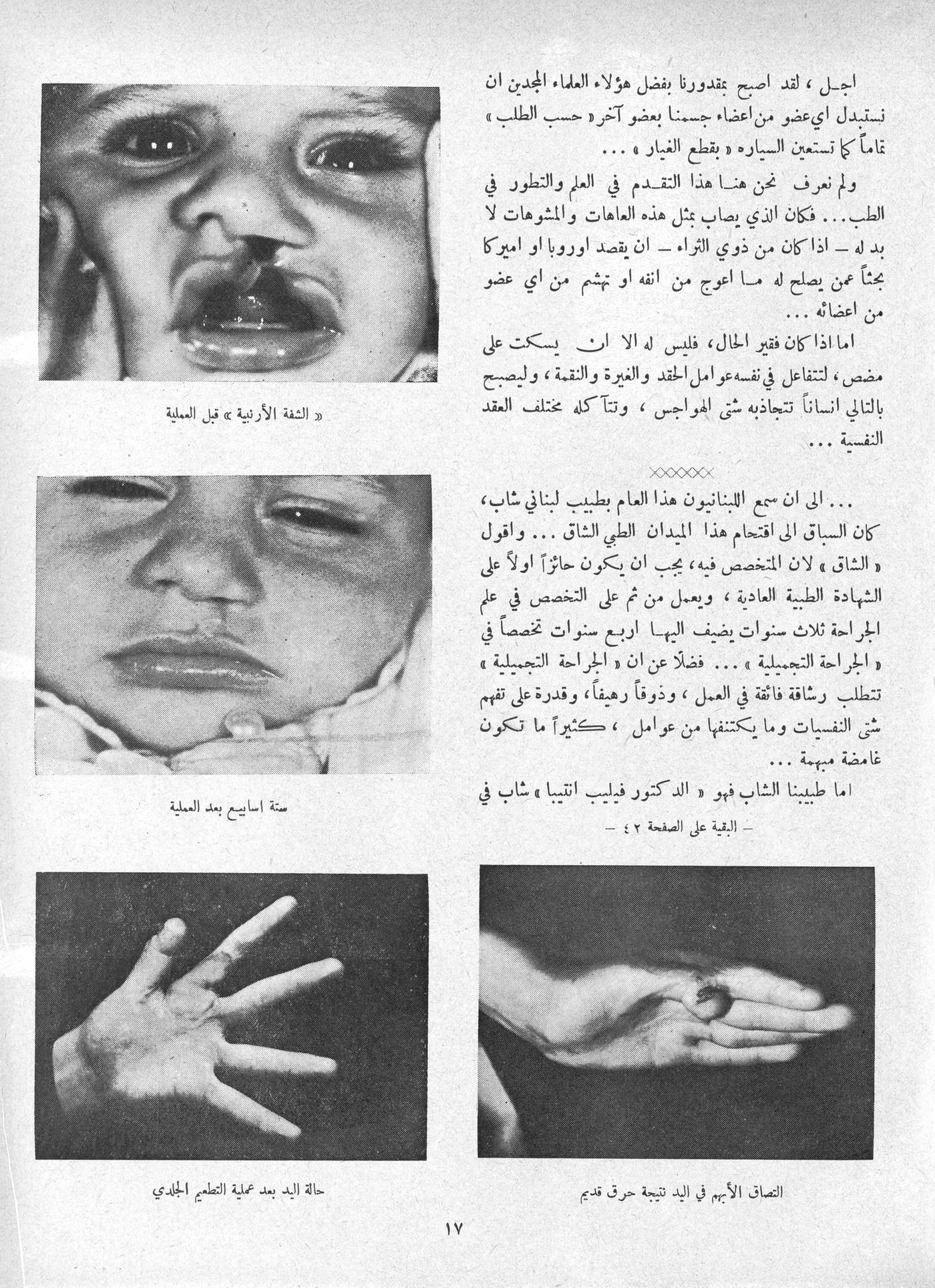 Scan of page 17